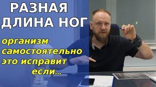 Разная длина ног и перекос таза у ребенка у взрослого причины и как исправить