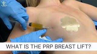Non-Surgical Breast Lift with Platelet-Rich Plasma PRP