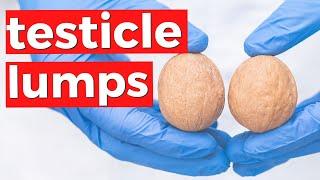 TESTICULAR CANCER - Why you should check your testicles for lumps