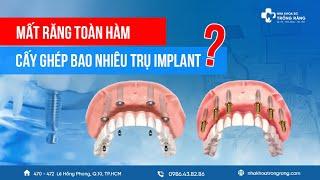 Mất răng toàn hàm cấy ghép bao nhiêu trụ implant?