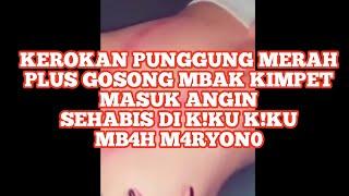 Kerokan punggung merah plus gosong mbak kimpet