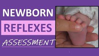 Newborn Reflexes Assessment Infant Nursing Pediatric NCLEX Review