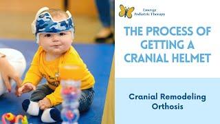 The Process Of Getting a Cranial Helmet Cranial Remodeling Orthosis