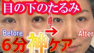 6 min Exercises and Massages to Remove Under Eye Bags Life Changing Miracle Guaranteed Morning