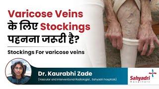 Varicose Veins के लिए Stockings पहनना जरूरी है?  Stockings For varicose veins  Dr Kaurabhi Zade