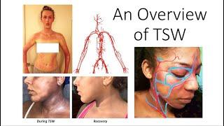 An Overview of TSW Topical Steroid Withdrawal