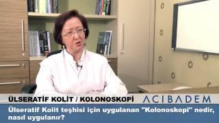 Ülseratif Kolit teşhisi için uygulanan Kolonoskopi nedir nasıl uygulanır?