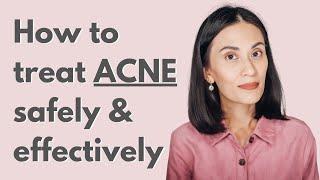 Safe and Effective Treatment for Mild to Moderate Acne  Dr Gaile Robredo-Vitas