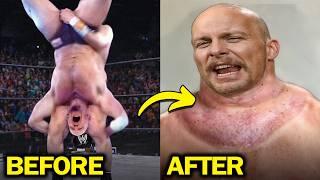 Injuries That Permanently Damaged WWE Wrestlers Bodies