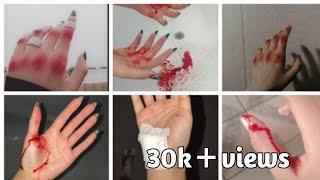 🫣 Accident dp ideas 2023  hand bandage dp for girls  hand cut dpz  cannula hand dp photo