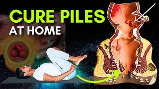 Piles Problem Treatment  Yoga for Piles  Cure Hemorrhoids with Simple Exercises #piles