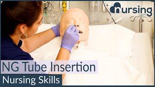 NG Nasogastric Tube Insertion Techniques Nursing Skills