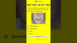 NEET MDS  INI-CET MDS  PSC  BDS - Most Important Questions  #neetmds2025 #mdsprep