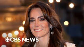 Kate Princess of Wales in hospital after planned abdominal surgery