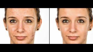 Photoshop Yüz Temizleme - Photoshop facial cleaning