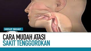 Sakit Tenggorokan Ini Penyebab dan Cara Atasinya  Hidup Sehat tvOne