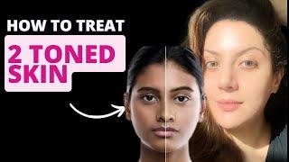 How To Get Glowing Skin 2-toned Skincare Routine I How to treat dull skin?