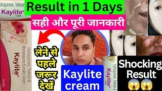 kaylite cream  kaylite cream ke fayde  kaylite cream lagane se kya hota hai  kaylite cream review