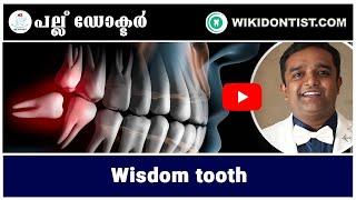 Pallu Doctor Wisdom Tooth