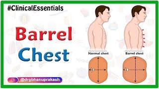 Barrel chest  Clinical essentials