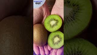 Diabetic dietary fruit Kiwi- health benefits  Swasthya Sambad