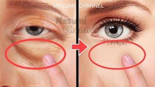9mins Eye Bags Removal Exercises Lift Up Dark Circles Under Eyes Eye Wrinkles Anti-Aging