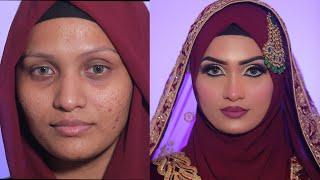 HOW TO COVER ACNE & SCARS EASILY  BRIDAL MAKEUP WITH HIJAB  Quick Simple and Easy