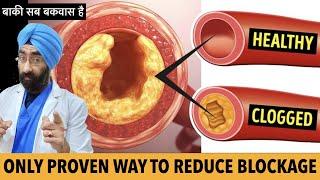 Only Proven Way To Clean Heart Blockage  Unclog Arteries  Do Statins Reverse plaque  Dr.Education