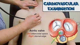 Cardiovascular Examination - OSCE Guide old version  UKMLA  CPSA