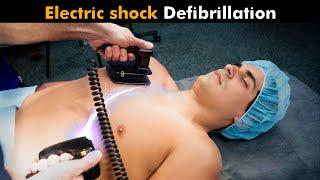 How Defibrillator Works? UrduHindi