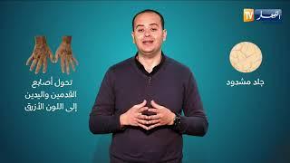 صحة MAG  هل مرض تصلب الجلد خطير ؟