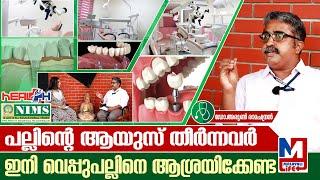 ദന്തൽ ഇംപ്ലാന്റേഷനെപ്പറ്റിയുള്ള സമ്പൂർണ വിവരങ്ങൾ I NIMS HEALTH PLUS