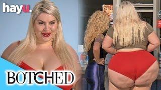 Natasha Crown Wants A Bigger Bum  Botched