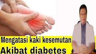 Cara mengatasi kaki kesemutan akibat diabetes