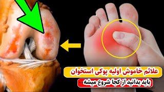 علائم اولیه پنهان پوکی استخوان که بیشتر مردم نمیدانند از کجا  پوکی استخوان شروع میشود