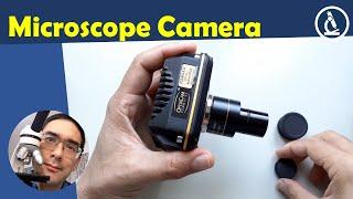   USB Microscope Camera review  Amateur Microscopy