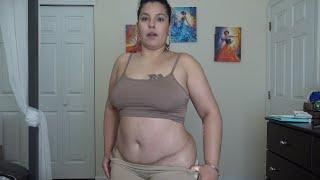 TWO YEARS AFTER MY TUMMY TUCK SURGERY