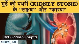 गुर्दे की पथरी के लक्षण कारण  Kidney Stone Symptoms Hindi Kidney ki Pathri Ke Lakshan aur Karan
