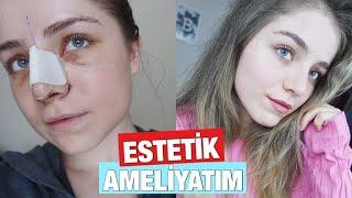 BAŞTAN SONA BURUN ESTETİĞİ AMELİYATIM  Fotoğraflar Vlog ve Soru-Cevap