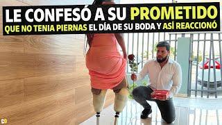 Le confesó a su prometido que no tenía piernas el día de su boda y así reacciono.