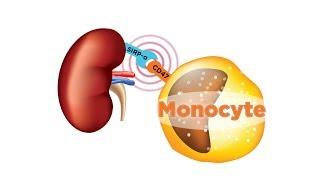 Earliest Molecular Events Leading to Organ Rejection Identified