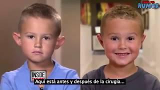 Mira por qué este niño de 6 años se somete a una cirugía plástica