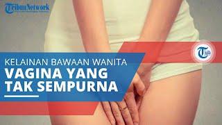 Vaginal Agenesis  Kelainan Bawaan Wanita Tidak Memiliki Vagina Leher Rahim Rahim atau Ovarium