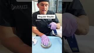 Surgical Stapler vs Regular Stapler  #shorts #plasticsurgery