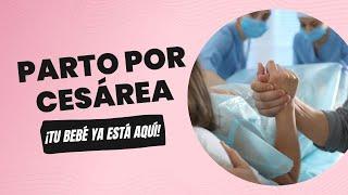 Parto Por Cesárea  Guía Completa para Futuras Mamás