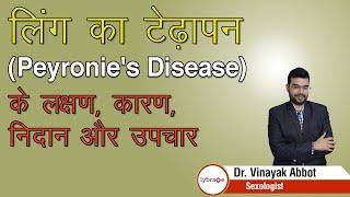 लिंग का टेढ़ापन Peyronies Disease के लक्षण कारण निदान और उपचार  Dr. Vinayak Abbot  Lybrate