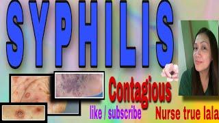 IS SYPHILIS CURABLE  nurse true lala