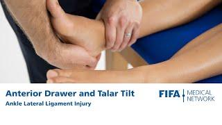 Anterior Drawer and Talar Tilt  Ankle Lateral Ligament Injury