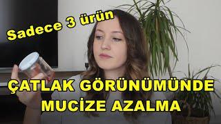 Hamilelik Çatlakları Nasıl Geçer? Çatlak Görünümünde Azalma - Kantaron Yağı