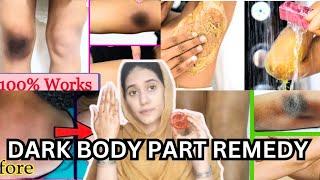 Get rid of Dark Neck Elbow Kneesfeet & knuckles at HomeDark Neck Remedyrahilaarslan007